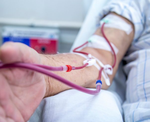 Benefits of Home Dialysis